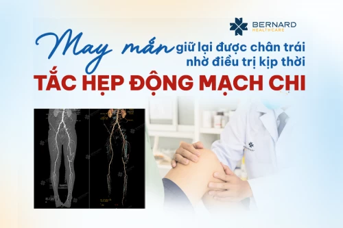 Kịp thời phát hiện và can thiệp tắc động mạch chi dưới, nam bệnh nhân 59 tuổi may mắn tránh được tình trạng cắt cụt chân trái